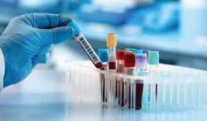 Alzheimer's blood test prediction and early detection research Alzheimer's blood test prediction and early detection research